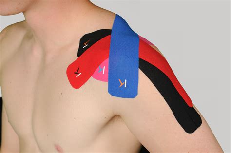 Two-Piece Bicep Tendonitis Taping. Place a piece of kinesiology tape on the front of the shoulder. Use 25% stretch and it should end just above the inside of the elbow. Take a second piece of kinesiology tape and place the top end slightly over the first piece of tape on the front of the shoulder. Bring the tape down slightly wider along the ...